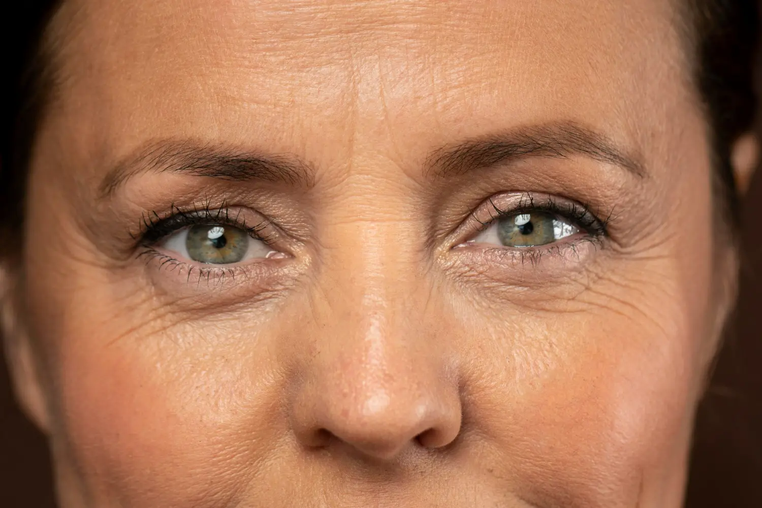 Close do rosto de uma mulher no pós-blefaroplastia, com olhar mais leve e pálpebras superiores definidas