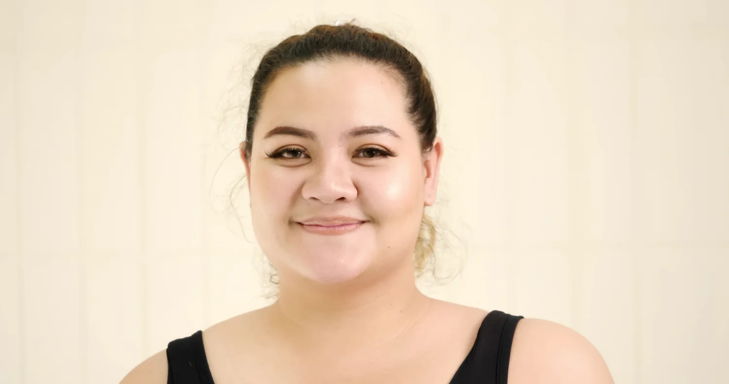  Rosto de mulher sorrindo com bolsas de gordura mais marcadas 