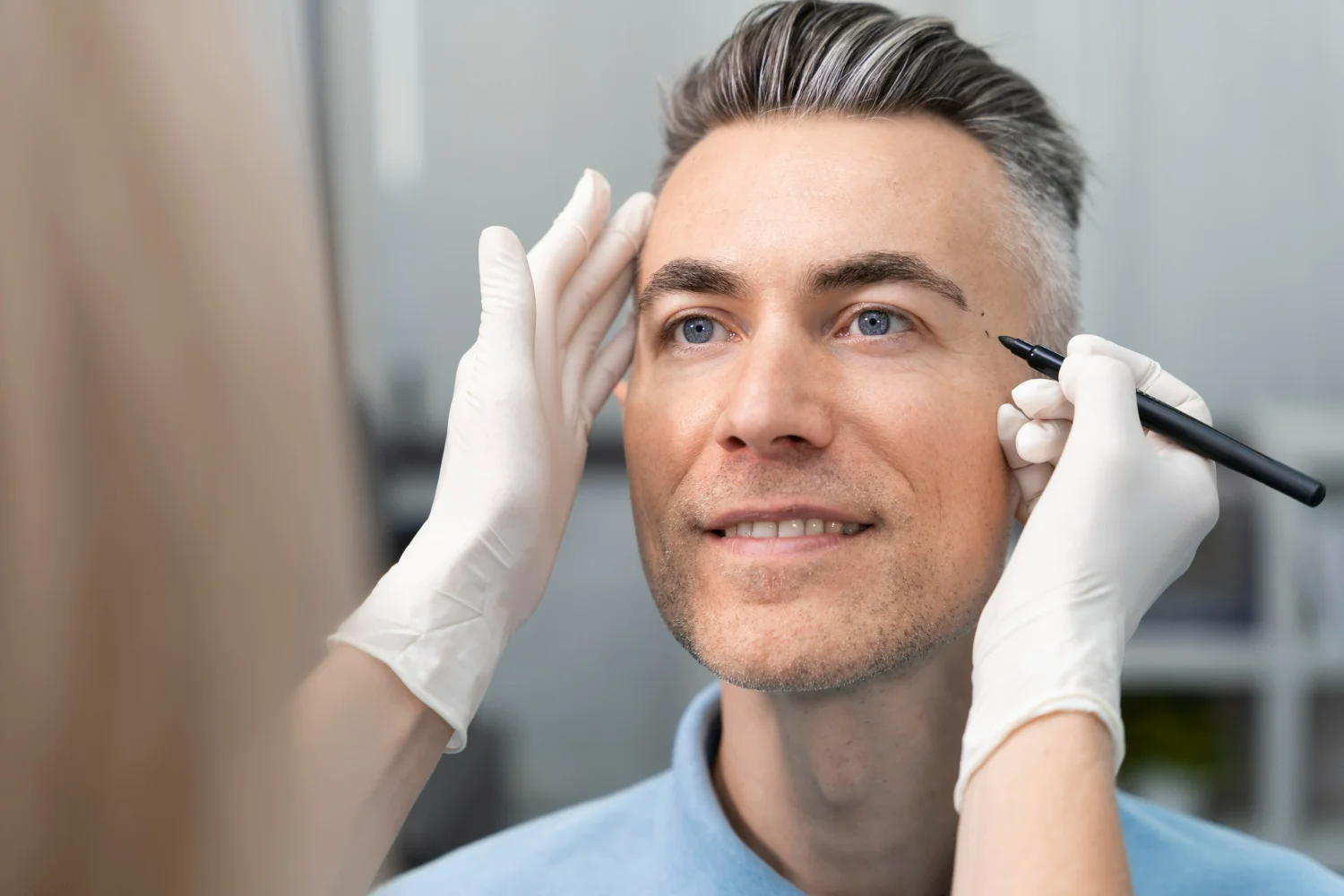 Homem em avaliação com marcação na região dos olhos para blefaroplastia masculina