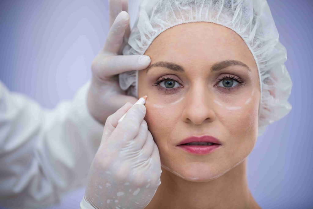 Médica marca a região dos olhos de paciente antes de procedimento de plástica para os olhos