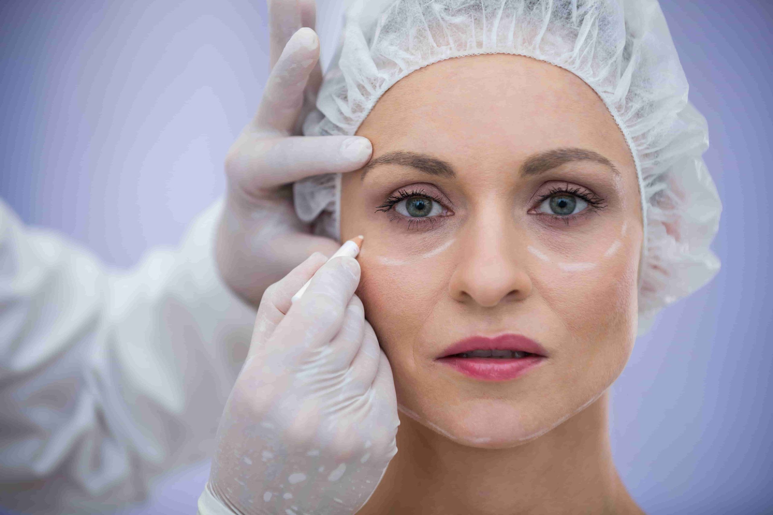 Médica marca a região dos olhos de paciente antes de procedimento de plástica para os olhos
